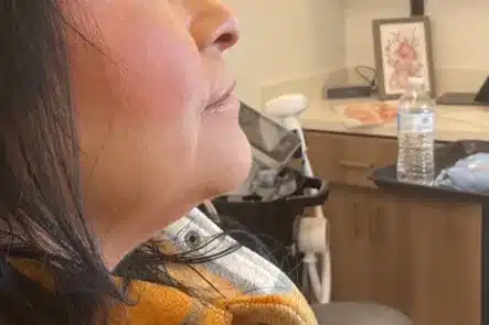 before double chin, neck and facetite treatment before double chin, neck and facetite treatment