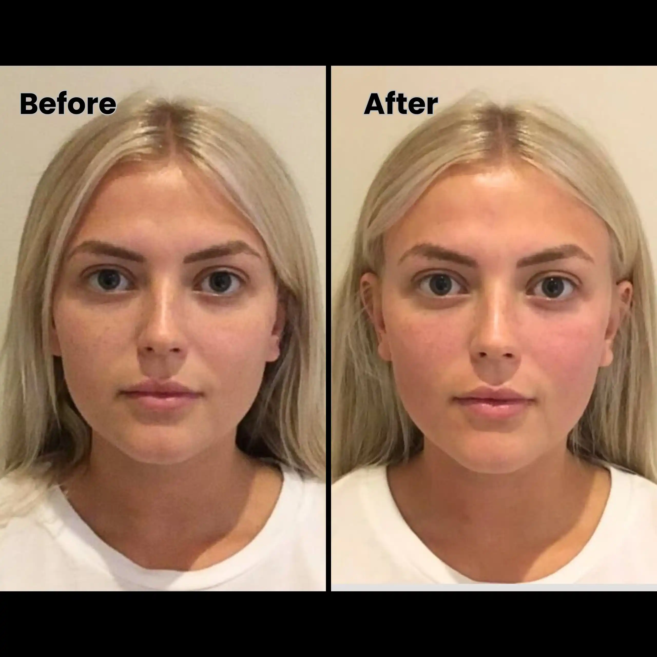 10 weeks semaglutide 10kgs in 10 weeks. : r/Semaglutide
