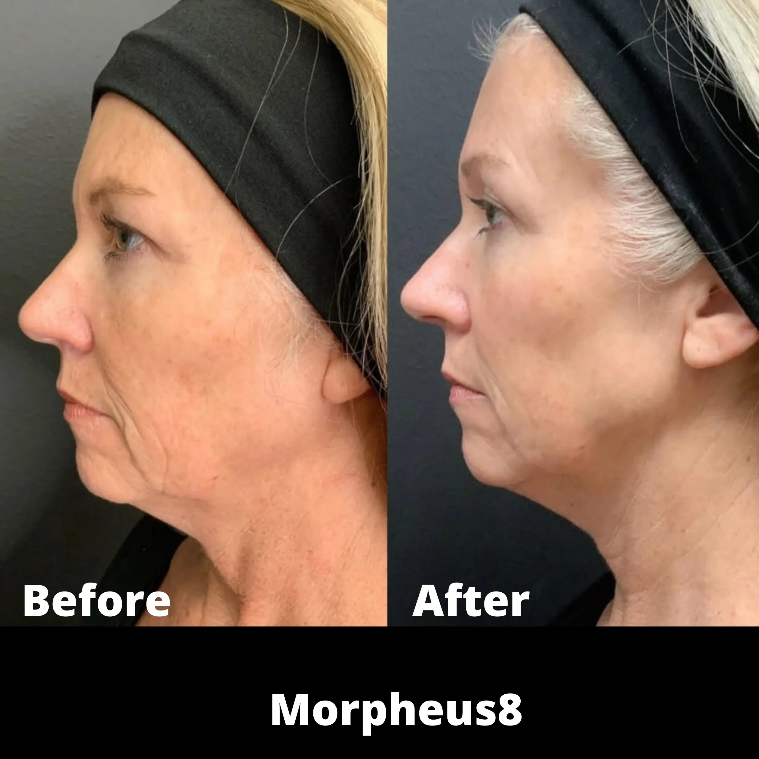 Morpheu8 Results